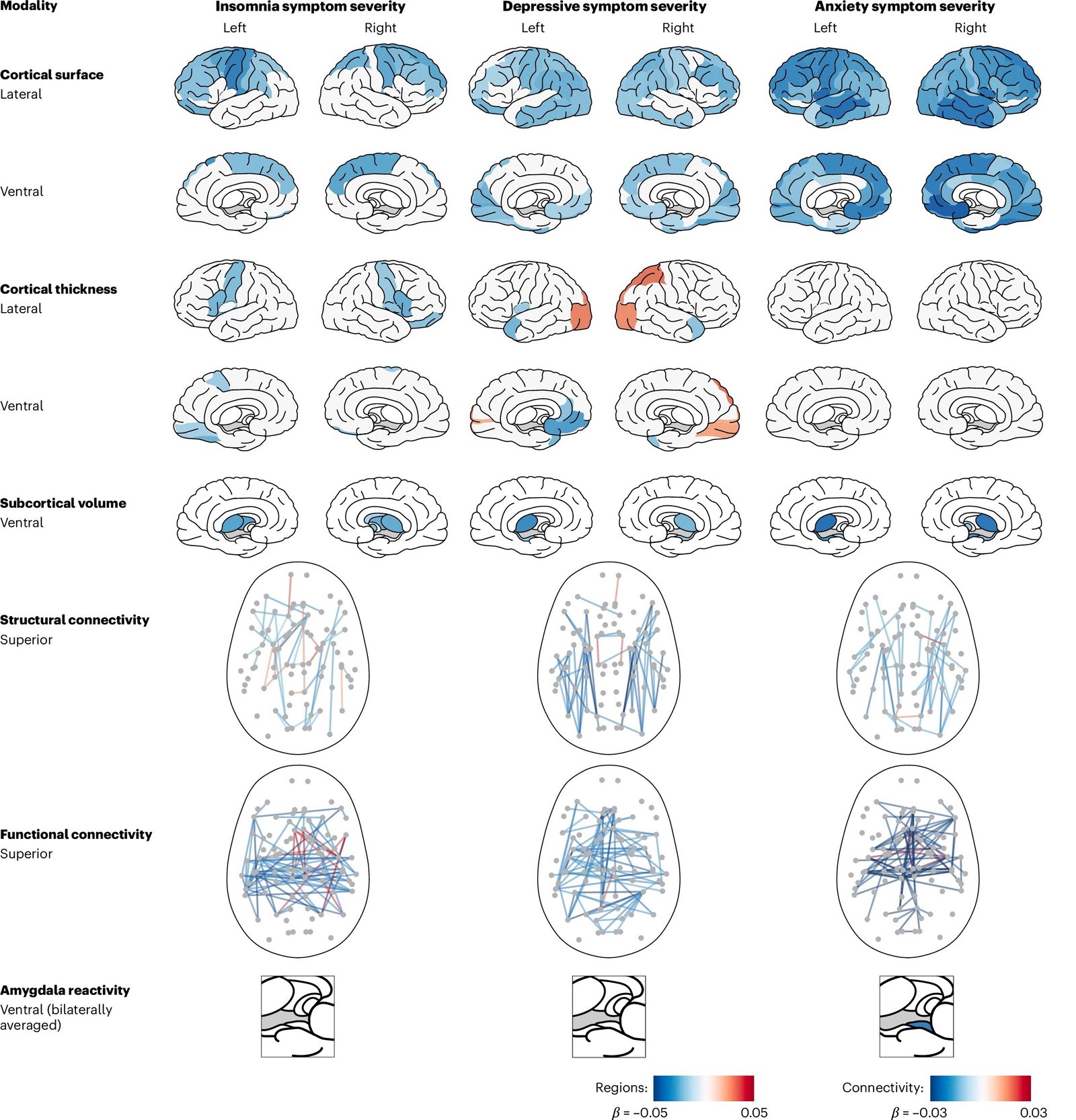 New study maps brain differences in insomnia, anxiety, depression